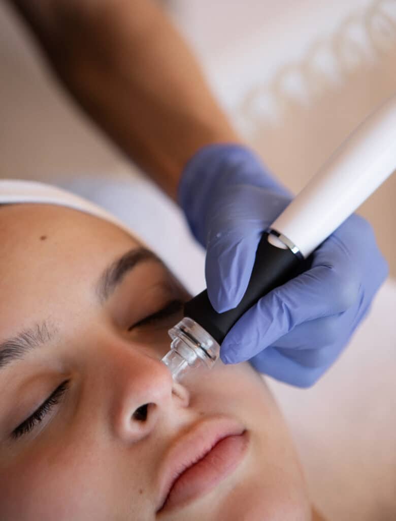 deep pore cleansing